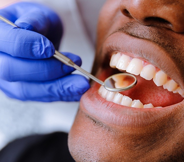 Man with metal free dental crown smiling